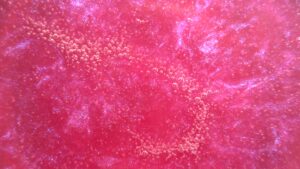 Pink Dodoris
